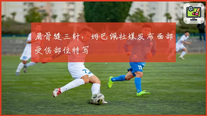 眉骨缝三针,姆巴佩社媒发布面部受伤部位特写