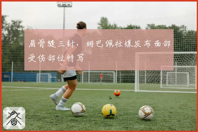 眉骨缝三针，姆巴佩社媒发布面部受伤部位特写